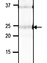 VPS29 | Vacuolar protein sorting-associated protein 29 in the group Antibodies Plant/Algal / Arabidopsis thaliana at Agrisera AB (Antibodies for research) (AS20 4401)